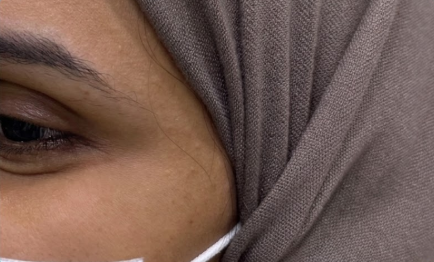 بعد علاج البشرة